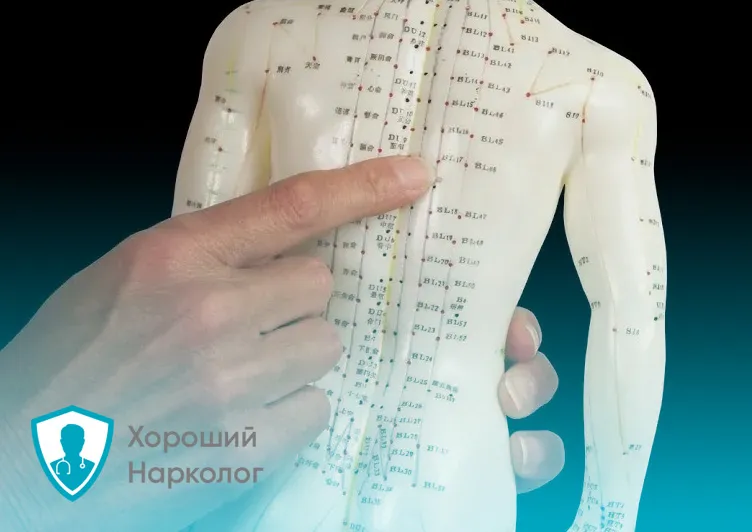 Кукла для акупунктуры и ИРТ кодирования от алкоголизма